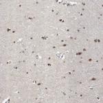 DMTF1 Antibody in Immunohistochemistry (Paraffin) (IHC (P))