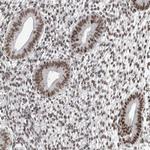 DMTF1 Antibody in Immunohistochemistry (Paraffin) (IHC (P))