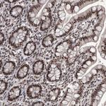 DMTF1 Antibody in Immunohistochemistry (Paraffin) (IHC (P))