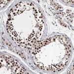 DMTF1 Antibody in Immunohistochemistry (Paraffin) (IHC (P))
