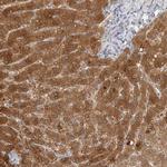 DCXR Antibody in Immunohistochemistry (Paraffin) (IHC (P))