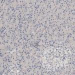 DCXR Polyclonal Antibody