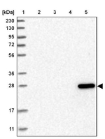 DCXR Antibody in Western Blot (WB)