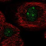 ARID5A Polyclonal Antibody