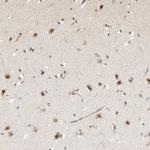 ARID5A Antibody in Immunohistochemistry (Paraffin) (IHC (P))