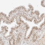 ARID5A Antibody in Immunohistochemistry (Paraffin) (IHC (P))