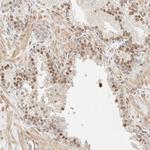 ARID5A Antibody in Immunohistochemistry (Paraffin) (IHC (P))