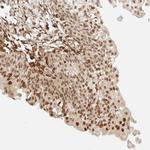 ARID5A Antibody in Immunohistochemistry (Paraffin) (IHC (P))