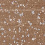 Fyn Antibody in Immunohistochemistry (Paraffin) (IHC (P))