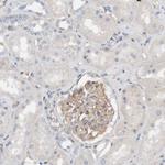 Fyn Antibody in Immunohistochemistry (Paraffin) (IHC (P))