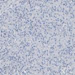 Fyn Antibody in Immunohistochemistry (Paraffin) (IHC (P))