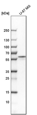Fyn Antibody in Western Blot (WB)
