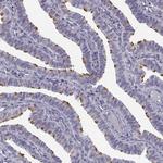 TTC25 Antibody in Immunohistochemistry (Paraffin) (IHC (P))
