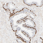 Cytokeratin 15 Antibody in Immunohistochemistry (Paraffin) (IHC (P))