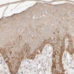 Cytokeratin 15 Antibody in Immunohistochemistry (Paraffin) (IHC (P))
