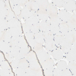 Cytokeratin 15 Antibody in Immunohistochemistry (Paraffin) (IHC (P))