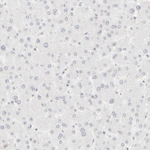 Cytokeratin 15 Antibody in Immunohistochemistry (Paraffin) (IHC (P))