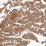 p40 Antibody in Immunohistochemistry (Paraffin) (IHC (P))