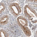 p40 Polyclonal Antibody