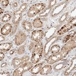 p40 Antibody in Immunohistochemistry (Paraffin) (IHC (P))