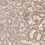 DEPDC6 Antibody in Immunohistochemistry (Paraffin) (IHC (P))