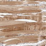 DEPDC6 Antibody in Immunohistochemistry (Paraffin) (IHC (P))