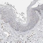 DEPDC6 Antibody in Immunohistochemistry (Paraffin) (IHC (P))