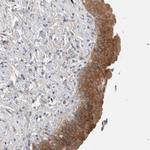 DEPDC6 Antibody in Immunohistochemistry (Paraffin) (IHC (P))