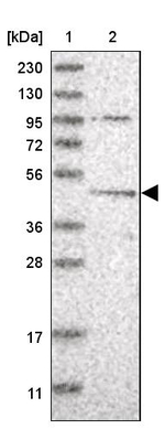 DEPDC6 Antibody in Western Blot (WB)