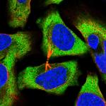 eIF3e Polyclonal Antibody