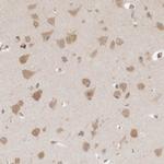 eIF3e Antibody in Immunohistochemistry (Paraffin) (IHC (P))