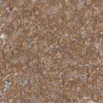 eIF3e Antibody in Immunohistochemistry (Paraffin) (IHC (P))