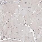 eIF3e Antibody in Immunohistochemistry (Paraffin) (IHC (P))