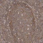 eIF3e Antibody in Immunohistochemistry (Paraffin) (IHC (P))