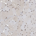 Nucleolin Antibody in Immunohistochemistry (Paraffin) (IHC (P))