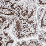 Nucleolin Antibody in Immunohistochemistry (Paraffin) (IHC (P))