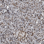 Nucleolin Antibody in Immunohistochemistry (Paraffin) (IHC (P))