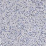 Arginase 1 Antibody in Immunohistochemistry (Paraffin) (IHC (P))
