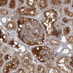 SERPINC1 Polyclonal Antibody