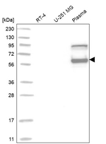 SERPINC1 Antibody in Western Blot (WB)