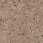PHGDH Antibody in Immunohistochemistry (Paraffin) (IHC (P))