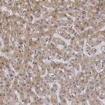 PHGDH Antibody in Immunohistochemistry (Paraffin) (IHC (P))