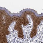 PHGDH Antibody in Immunohistochemistry (Paraffin) (IHC (P))