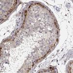 PHGDH Antibody in Immunohistochemistry (Paraffin) (IHC (P))