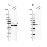 PHGDH Antibody in Western Blot (WB)