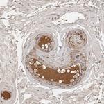 Complement Factor I Antibody in Immunohistochemistry (Paraffin) (IHC (P))