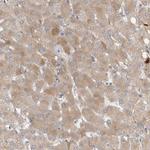 Complement Factor I Antibody in Immunohistochemistry (Paraffin) (IHC (P))