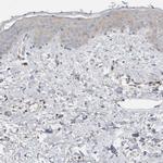 Complement Factor I Polyclonal Antibody