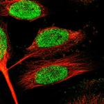 ZNF24 Polyclonal Antibody