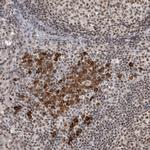 ZNF24 Antibody in Immunohistochemistry (Paraffin) (IHC (P))